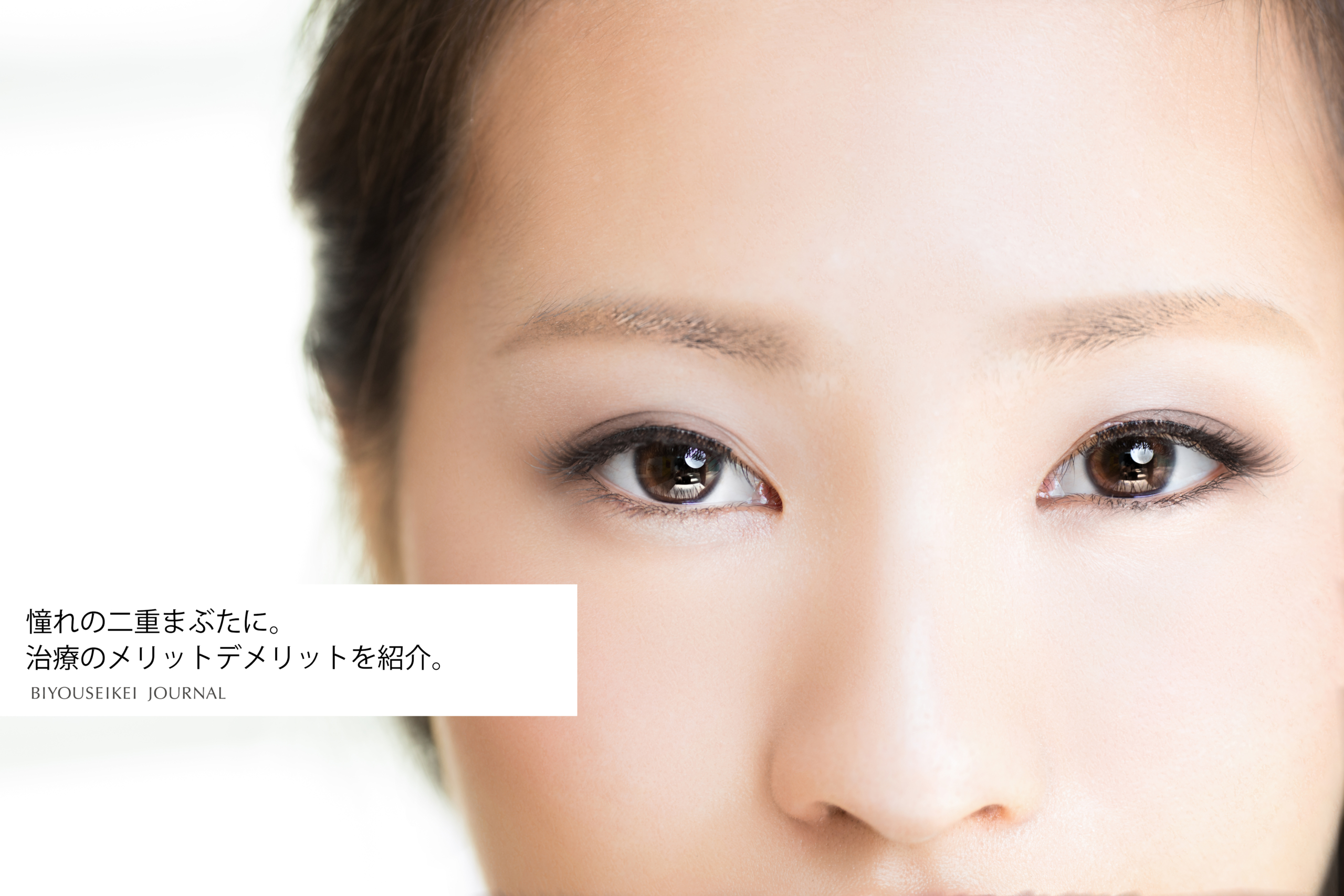 あこがれの二重まぶたに 治療のメリット デメリットをご紹介